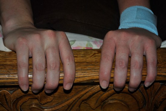 hands gripping footboard of bed